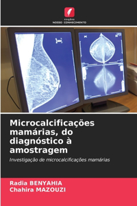 Microcalcificações mamárias, do diagnóstico à amostragem