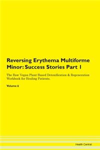 Reversing Erythema Multiforme Minor: Suc