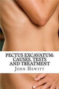 Pectus Excavatum