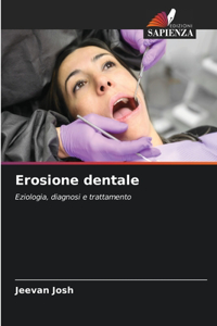 Erosione dentale