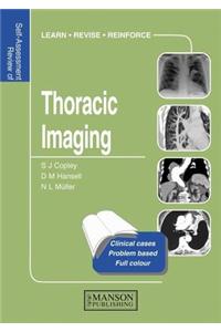Thoracic Imaging: Self-Assessment Colour Review