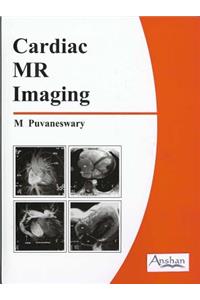 Cardiac MR Imaging