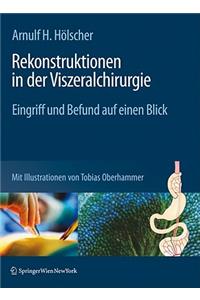 Rekonstruktionen in Der Viszeralchirurgie