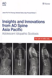 INSIGHTS AND INNOVATIONS FROM AO SPINE ASIA PACIFIC: ADOLESCENT IDIOPATHIC SCOLIOSIS