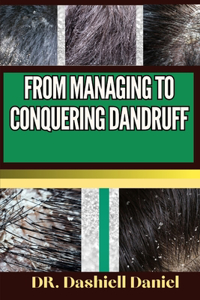 From Managing to Conquering Dandruff