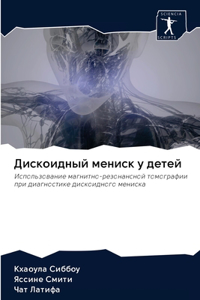 Дискоидный мениск у детей