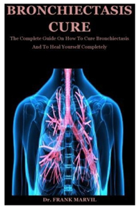 Bronchiectasis Cure: The Complete Guide On How To Cure Bronchiectasis And To Heal Yourself Completely