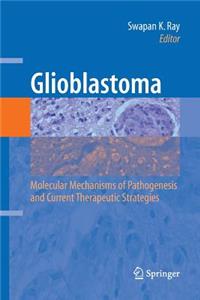 Glioblastoma: