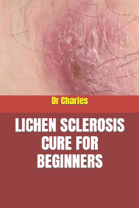 Lichen Sclerosis Cure for Beginners