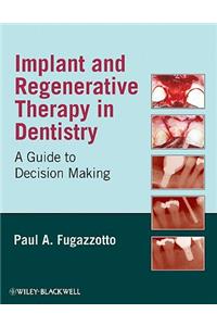 Implant and Regenerative Therapy in Dentistry