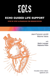 Echo Guided Life Support (EGLS)