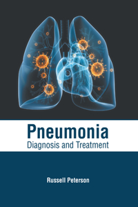 Pneumonia: Diagnosis and Treatment