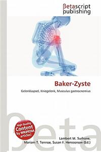Baker-Zyste