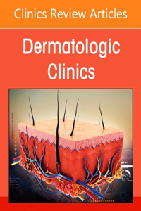 Hair, an Issue of Dermatologic Clinics, E-Book