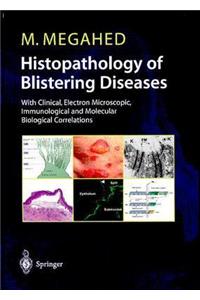 Histopathology of Blistering Diseases