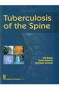 Tuberculosis of the Spine