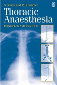 Thoracic Anaesthesia: Principles and Practice