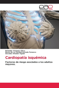 Cardiopatía isquémica