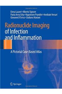 Radionuclide Imaging of Infection and Inflammation