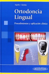 Ortodoncia Lingual/ Lingual Orthodontics