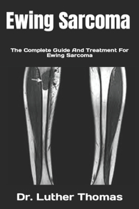 Ewing Sarcoma