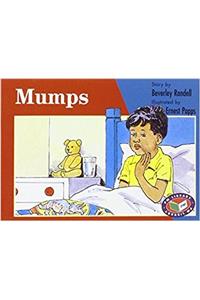 Mumps