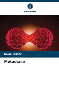 Metastase