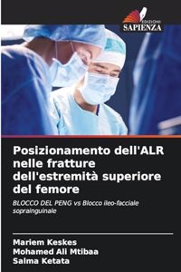 Posizionamento dell'ALR nelle fratture dell'estremità superiore del femore