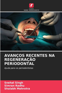 Avanços Recentes Na Regeneração Periodontal