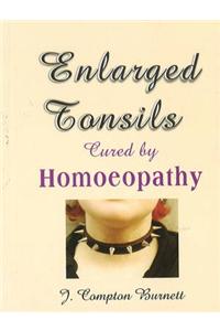 Enlarged Tonsils Cured by Homoeopathy