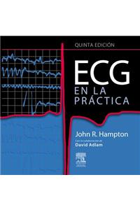 ECG En La Práctica
