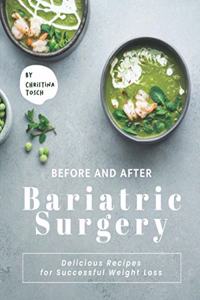 Before and After Bariatric Surgery