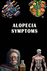 Alopecia Symptoms