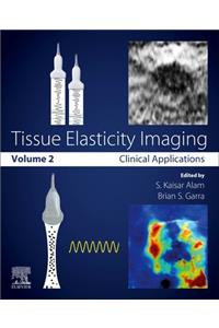 Tissue Elasticity Imaging