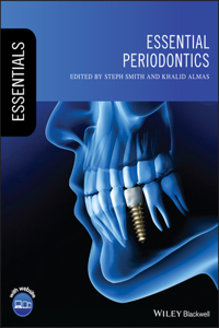 Essential Periodontics