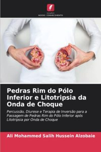 Pedras Rim do Pólo Inferior e Litotripsia da Onda de Choque