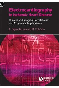 Electrocardiography in Ischemic Heart Disease