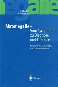 Akromegalie -- Vom Symptom Zu Diagnose Und Therapie