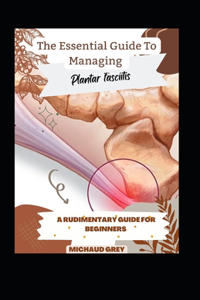 Essential Guide To Managing Plantar Fasciitis