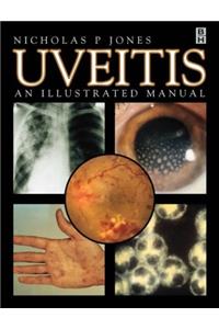 Uveitis: An Illustrated Manual: pa