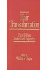 Hair Transplantation, 3/E