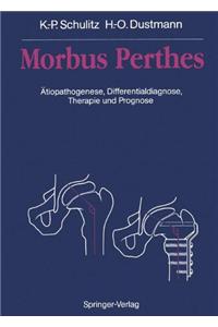 Morbus Perthes: Tiopathogenese, Differentialdiagnose, Therapie Und Prognose