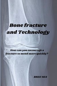 Bone fracture and Technology