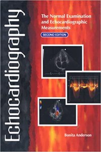 Echocardiography