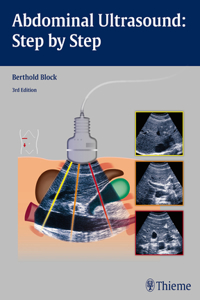 Abdominal Ultrasound: Step by Step