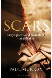 Scars