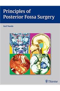 Principles of Posterior Fossa Surgery