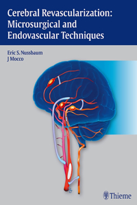 Cerebral Revascularization: Microsurgical and Endovascular Techniques