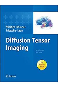 Diffusion Tensor Imaging