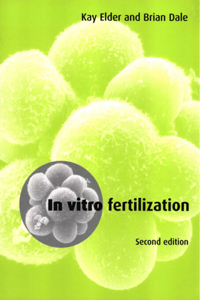 In Vitro Fertilization